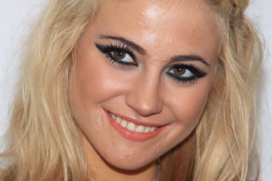 So are we going to give Pixie Lott a hard time for her acne