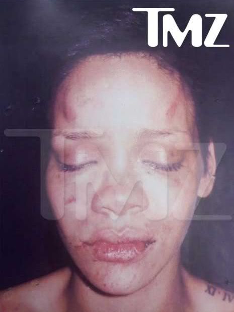 rihanna pictures after beating. Rihanna Photo After Chris