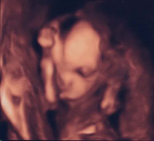 18-wk4dultrasound.jpg