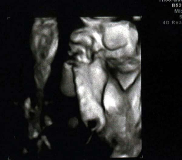 30wks--playingfootsie.jpg