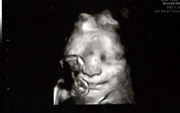 30wks--smiling.jpg