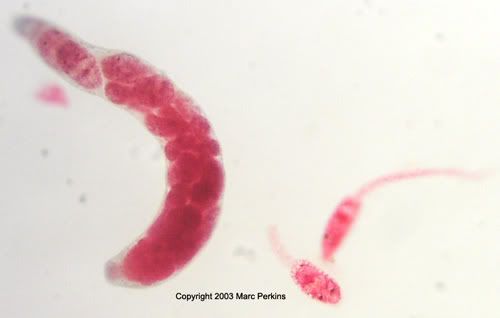 Ribeiroia+ondatrae+life+cycle